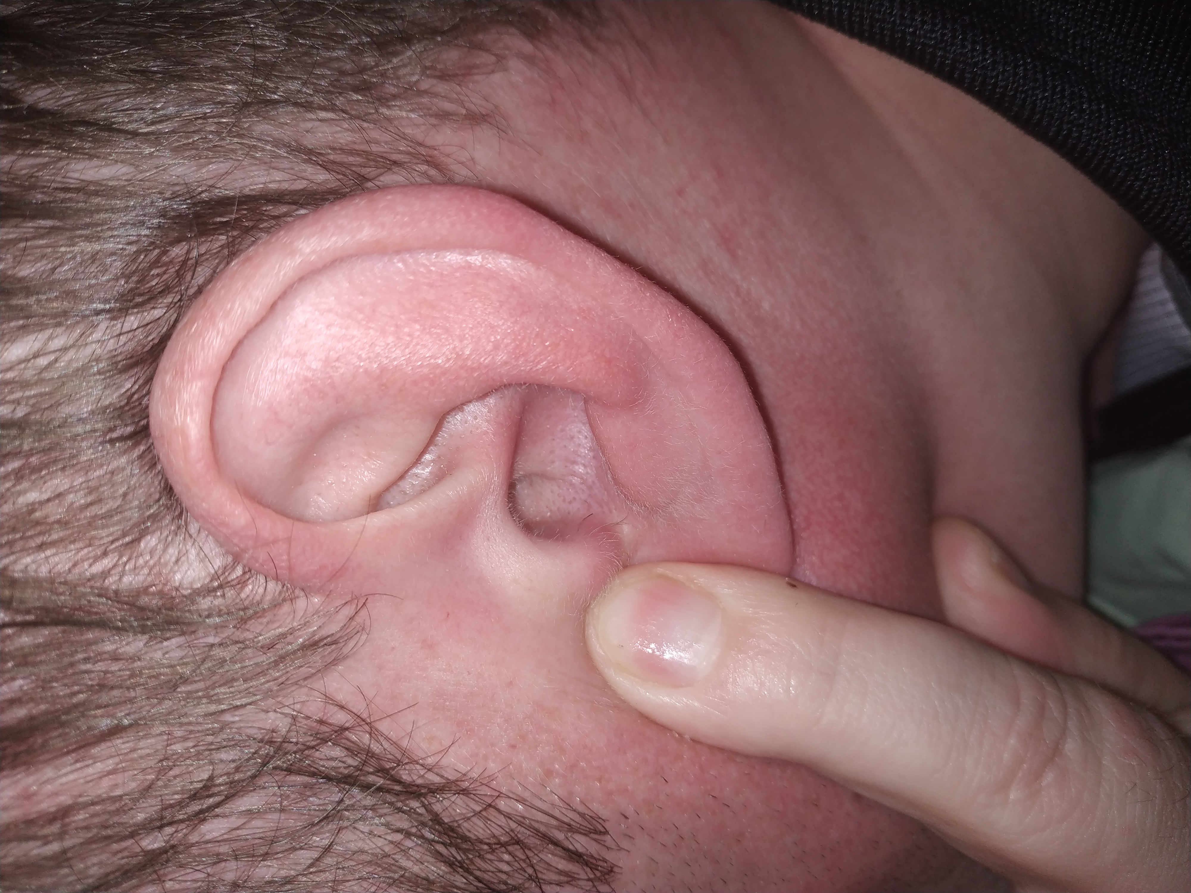 А у Вас когда начали расти волосы из ушей? Это означает старость, да?